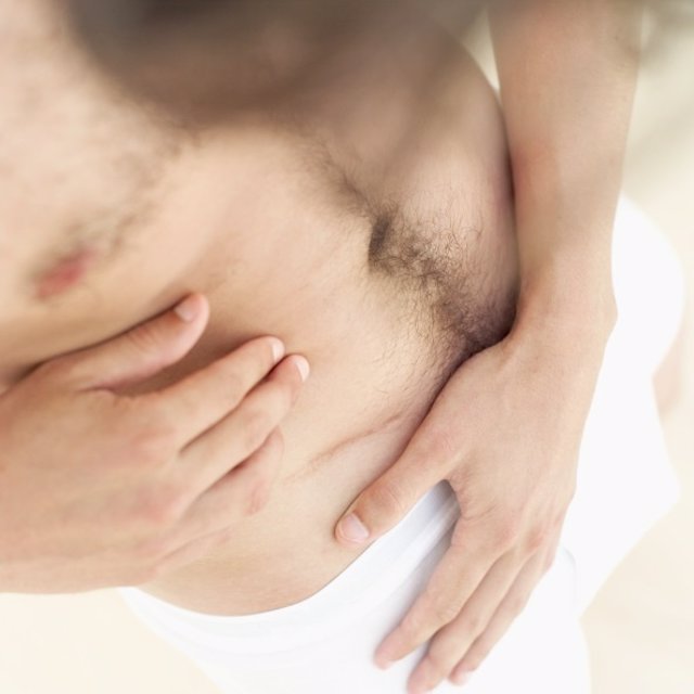 Hombre, cicatriz, hernia enguinal
