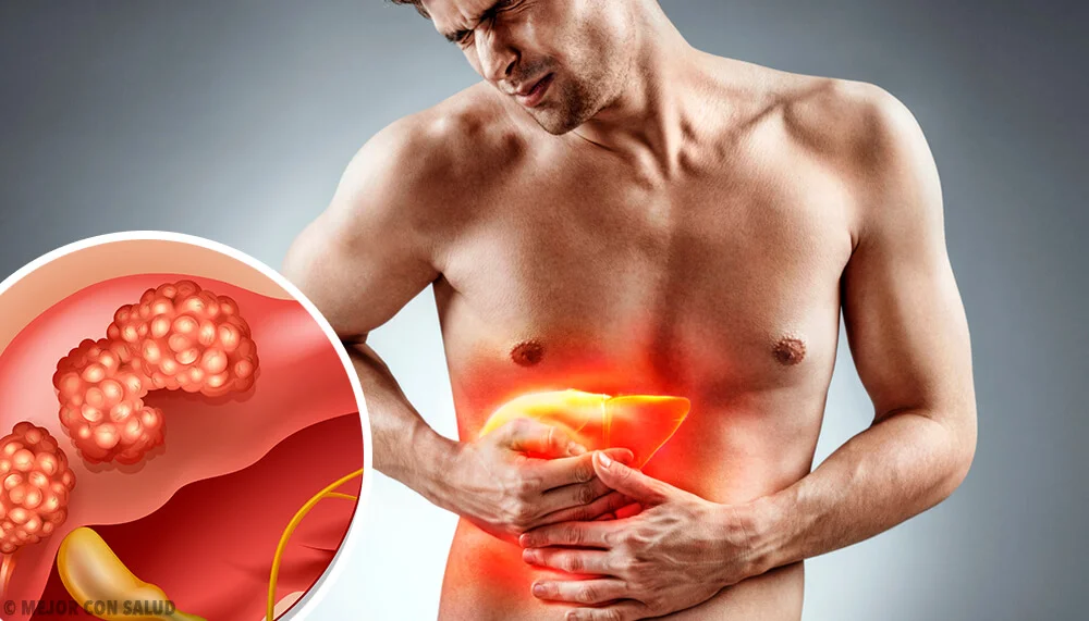 Cáncer-de-hígado-todo-lo-que-debes-saber